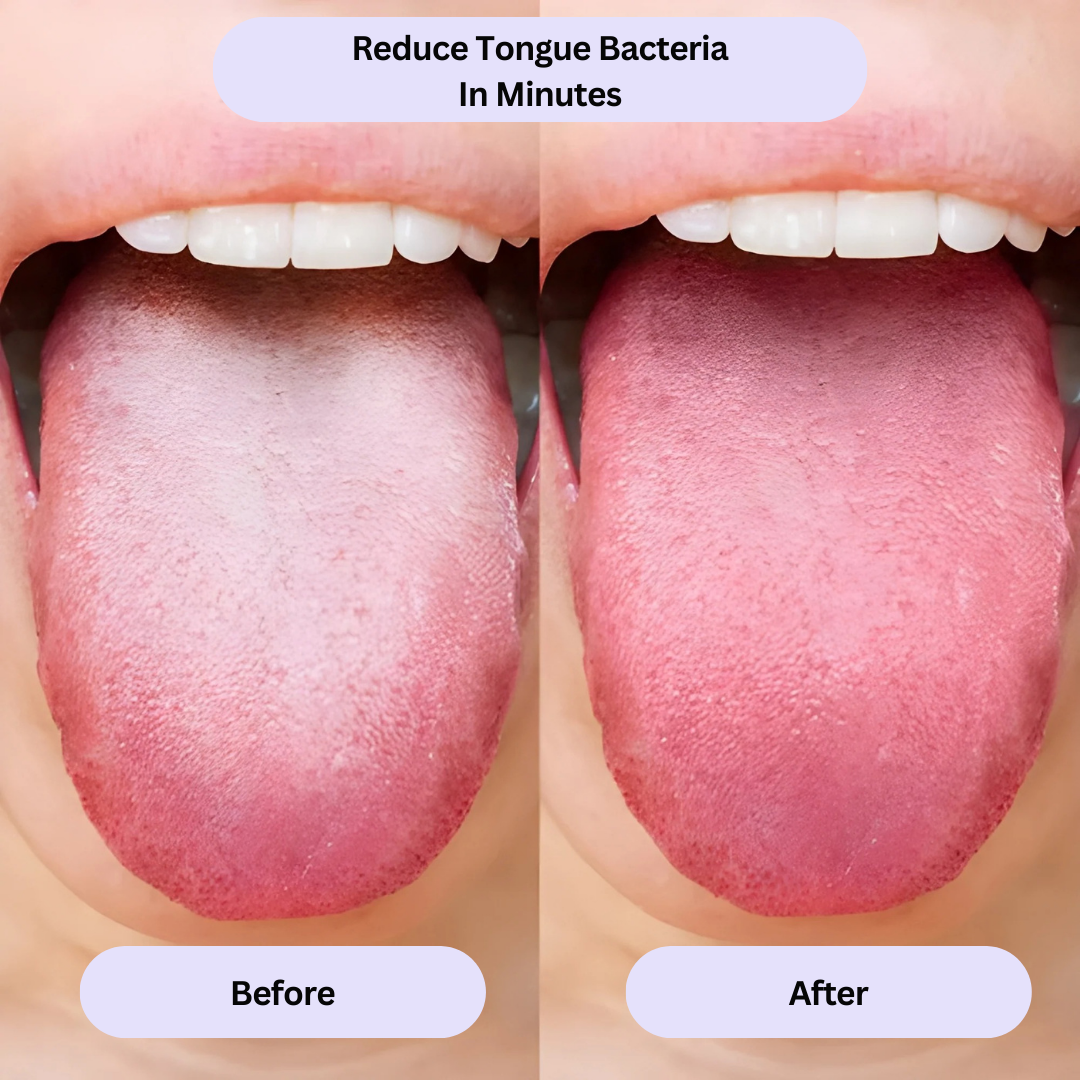 Probiotic Breath Mist