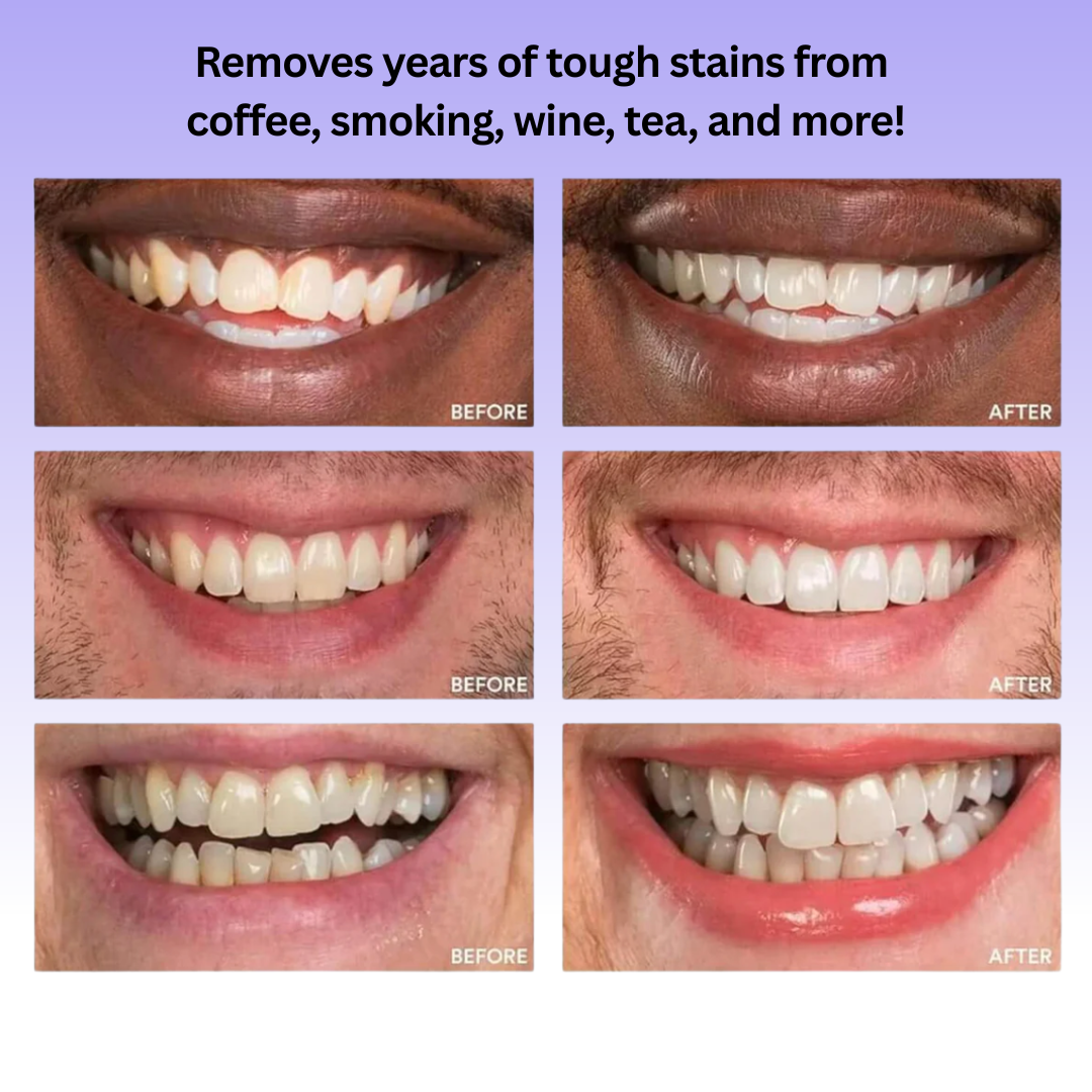 Instant Color-Correcting Toothpaste