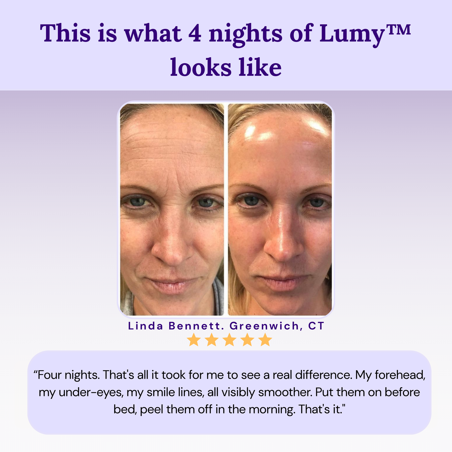 Lumy™ Peptide Infused Face Tape