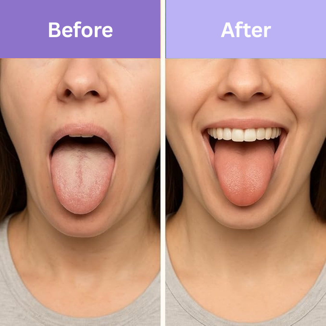 Tongue Scraper