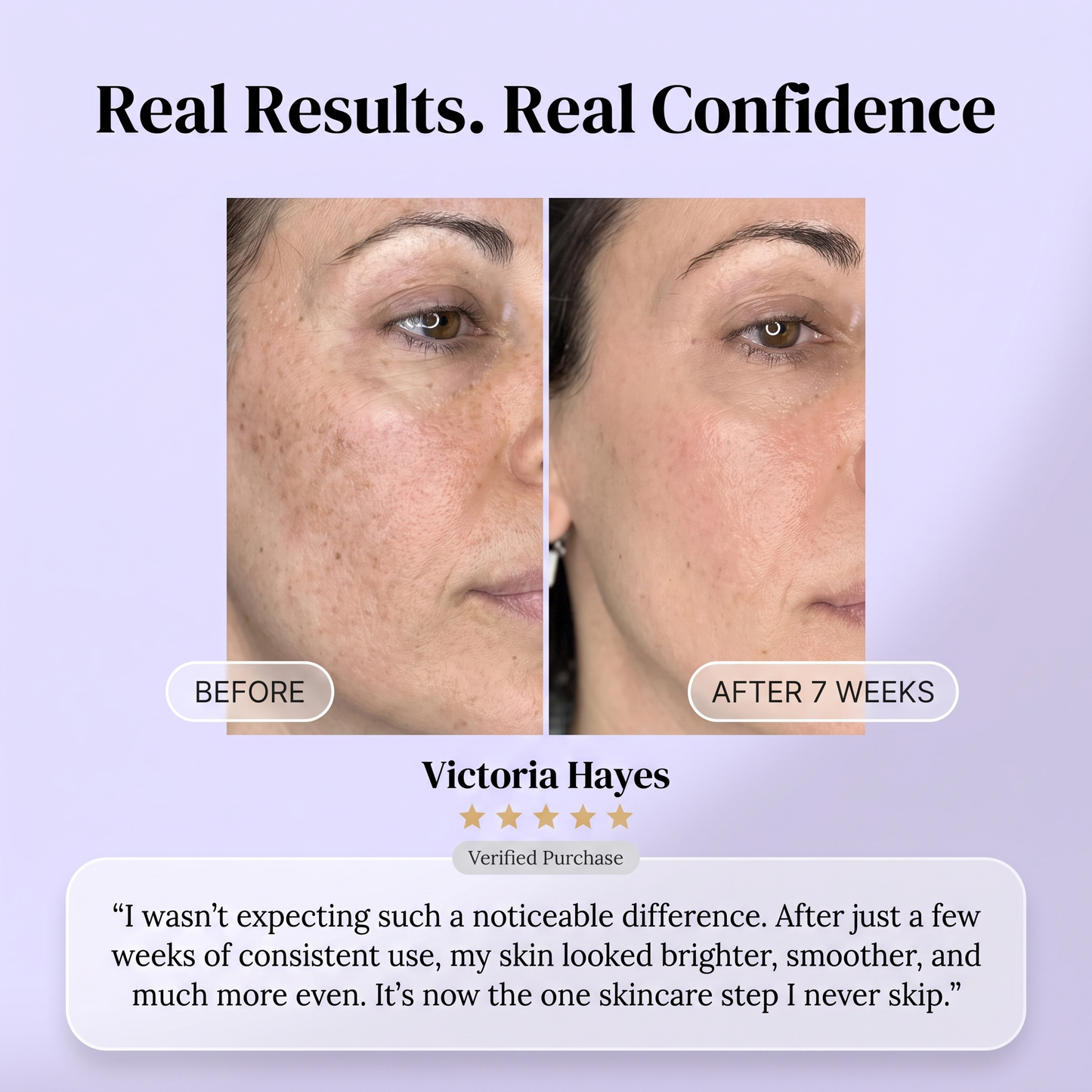 LumaVeil™-Led Face Mask