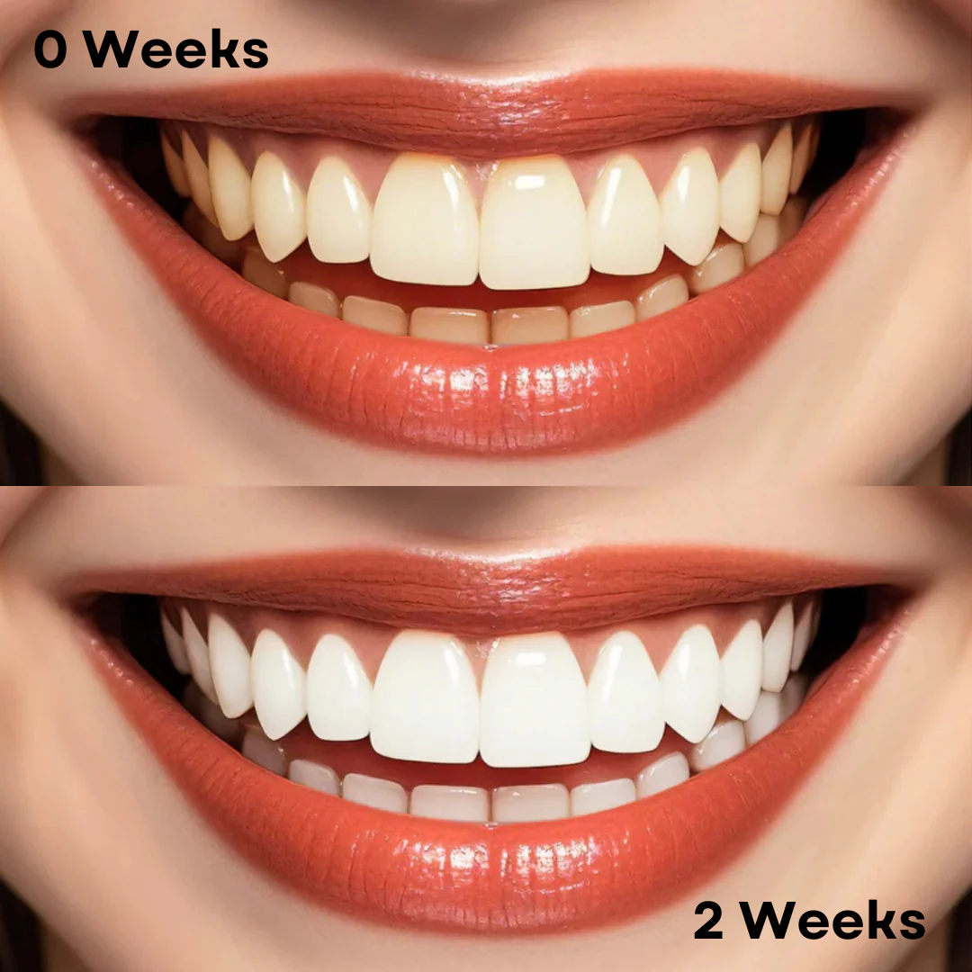 Professional Whitening Toothpaste